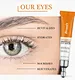 under eye cream for dark circles